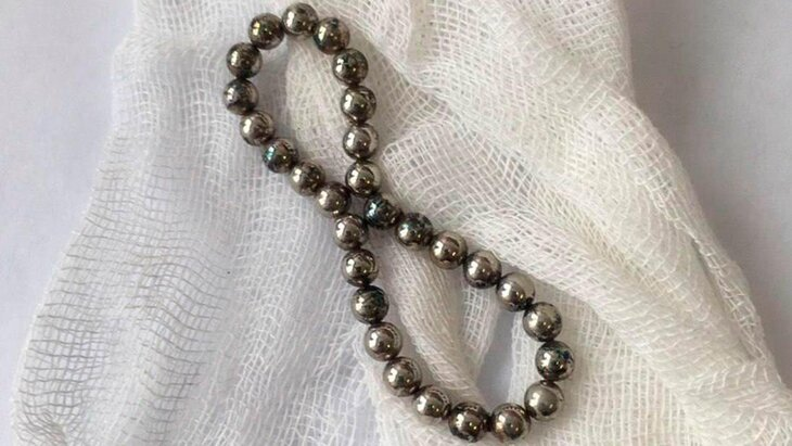 Подмосковные врачи спасли 4-летнюю девочку, проглотившую конструктор